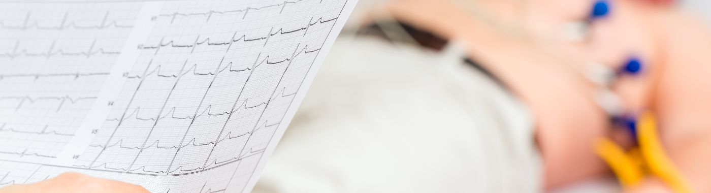 Angiogram Test